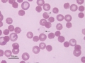 Ghost RBC & oxidant injury (dog)