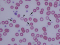 Hypochromic & normochromic (dog)
