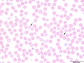 Hypochromic subpopulation (dog)