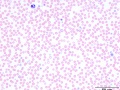 Hyopochromic subpopulation (dog)