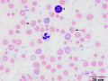Basophilic stippling (calf)