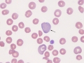Shift reticulocyte (dog)