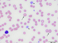 Siderocytes (cat)