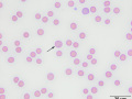 Siderocytes (cat)