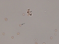 Agglutination & spherocytes (dog)