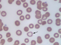 Torocyte