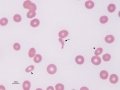 Dacryocyte & Elliptocyte (dog)