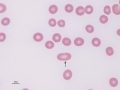 Elliptocyte (dog)