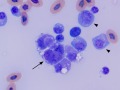 Macrophages