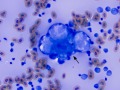 Macrophages