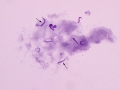Sperm (tortoise)