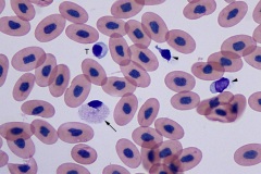Skink blood