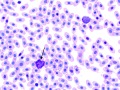 Azurophil & basophil (prehensile)