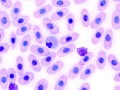 Eosinophil (prehensile)