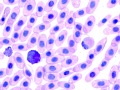 Leukocytes (prehensile)