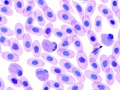 Heterophils & eosinophil (prehensile)