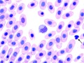 Monocyte & lymphocyte (prehensile)