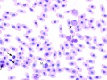Leukocytes (prehensile)