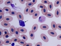 "False" band, azurophil & thrombocyte (unknown)