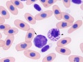Azurophil & basophil (prehensile)