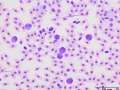 Leukocytes (prehensile)