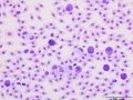 Leukocytes (prehensile)