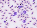 Leukocytes (prehensile skink)