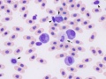 Leukocytes (prehensile)