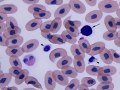 Heterophil, basophil & thrombocytes (unknown species)