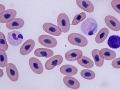 Heterophil & basophil (unknown species)