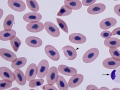 Eosinophil & keratocytes (unknown species)