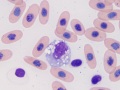 Monocyte & thrombocyte (prehensile)