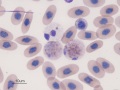 Heterophil & eosinophil (unknown)