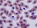 Lymphocyte, eosinophil, & thrombocyte (unknown species)