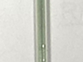 Biliverdinemia