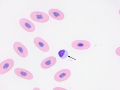 Inclusion body disease (Boa)
