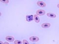 Mitotic figure