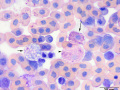Heterophil (toxic) & eosinophil