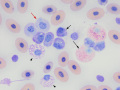 Heterophil, eosinophil & azurophil (viper)