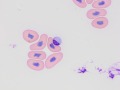 Inclusion body disease