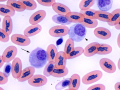 Azurophil & monocyte