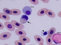 Erythrophagia (python)