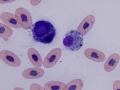 Hemosiderin (python)