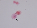 Hemosiderin (python)