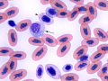 Monocyte & polychromatophil