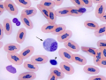 Monocyte & thrombocyte