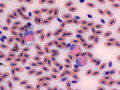 Toxic heterophils & monocyte