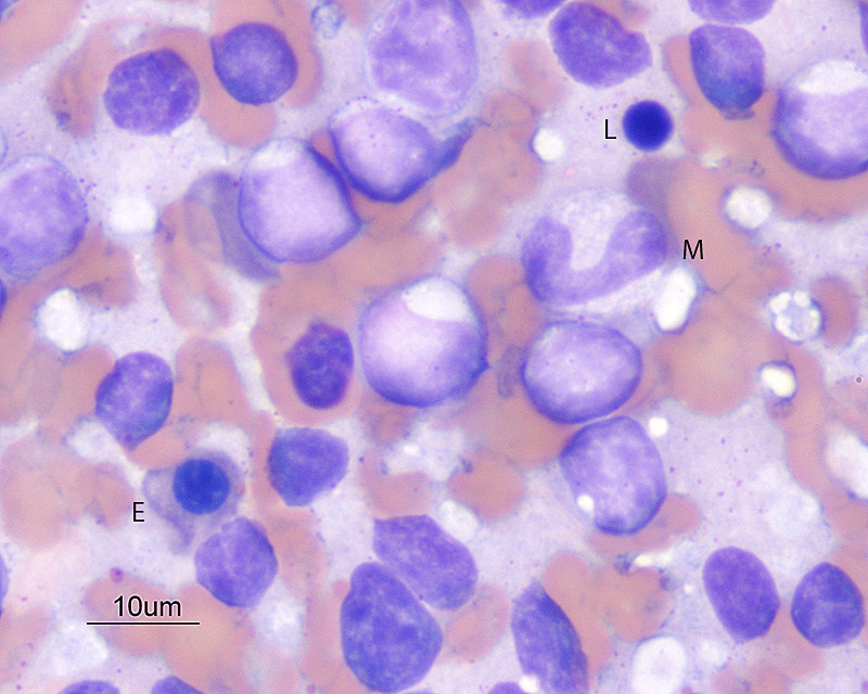 Lymphoma of granular lymphocytes (dog)