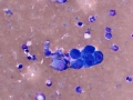 Hemangiosarcoma
