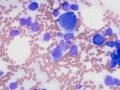 Round cell tumor (cat)